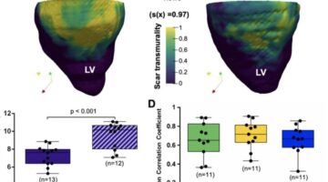 crean tecnica 3d evaluar cicatrizacion tras infarto. Fuente Scientific Reports