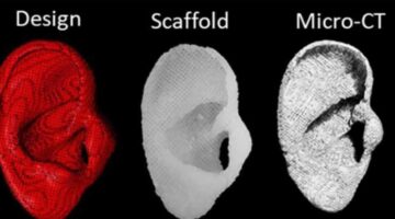 crean tecnologia implantes auriculares biodegradables. Foto Biofabrication