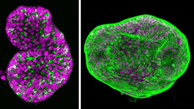 descubren diana terapeutica para cancer de prostata neuroendocrino con organoides. Foto Ankur Singh