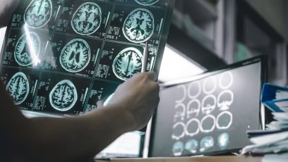 dispositivos neurologicos los mas innovadores para la FDA