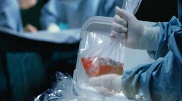 Parámetros para el proceso de donación de órganos – Circular 007 de 2016