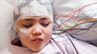 epilepsia