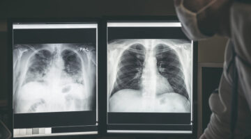 EPOC Medicina regenerativa basada en células madre