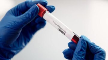 estudio seroprevalencia Medellin