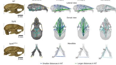 exceso de interferon sindrome de down. Fuente Nature Genetics