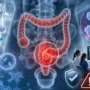 FDA aprueba dostarlimab para cáncer de recto localmente avanzado MSI-H o dMMR: nuevos datos y advertencias clínicas