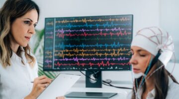 logran dosificar estimulacion cerebral