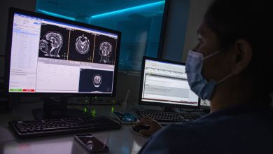 modelo computacional UNAL identifica casos discapacidad cognitiva. Fuente: UNAL.