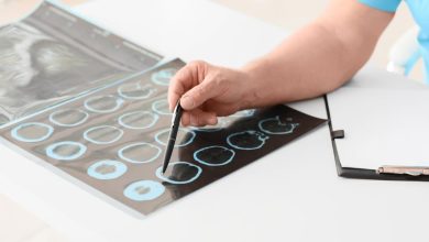 modelo detecta señales individuales alzheimer