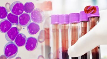 OMS alerta sobre ICLUSIG e ICLUSIG falsificado  para tratamiento de leucemia