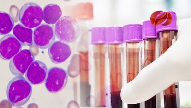 OMS alerta sobre ICLUSIG e ICLUSIG falsificado  para tratamiento de leucemia