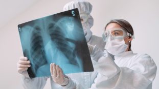 proponen modelo computacional tuberculosis