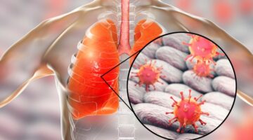 Antibióticos debilitan las defensas de la gripe en el pulmón: Estudio