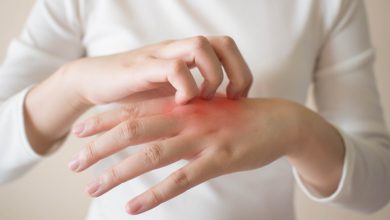 Colombia presenta las guías de práctica clínica para la dermatitis atópica, únicas en Latinoamérica