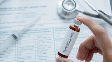 tuberculosis