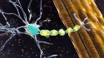 EMA recomienda autorización tratamiento de ELA en Europa: un paso adelante en la lucha contra esta enfermedad huérfana