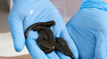 Doctor,Holding,Medical,Leeches.,Hirudotherapy.,Alternative,Medicine,,Bloodletting,And,Rejuvenation