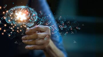 Alzheimer's,Disease,Concept,,Elderly,Woman,Holding,Brain,Symbol,Of,Missing