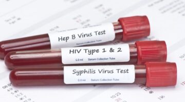 Más de un millón de infecciones de transmisión sexual se contagian diariamente