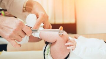 anomalías genéticas en los bebés