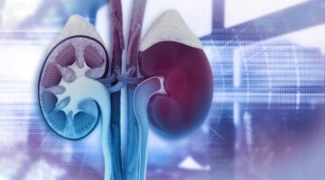 variante omicron y su impacto en los pacientes con hemodialisis colombia