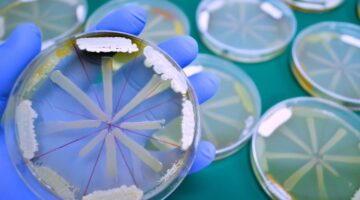 ¿Cambia la resistencia a los antibióticos en cada país nuevos hallazgos