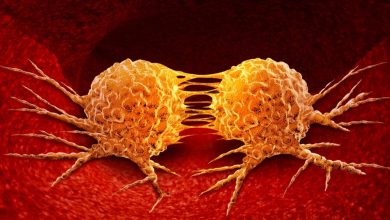 ¿Cómo hacen metástasis las células cancerosas (1)