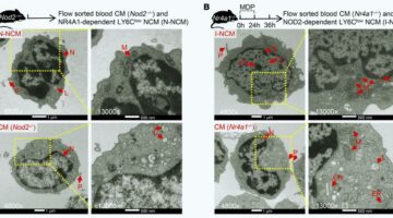 ¿Oportunidad oculta COVID-19 podría cambiar la lucha contra el cáncer