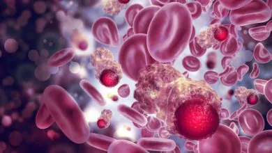 ¿Qué pasa con los cánceres raros en el mundo